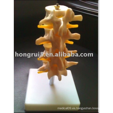 ISO Humano Normal Set lumbar (4 piezas), Lumber Esqueleto modelo